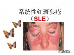 系统性红斑狼疮可以备孕嘛