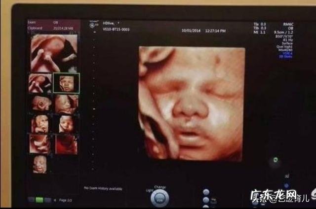 四维产检在多少周时去做最好?