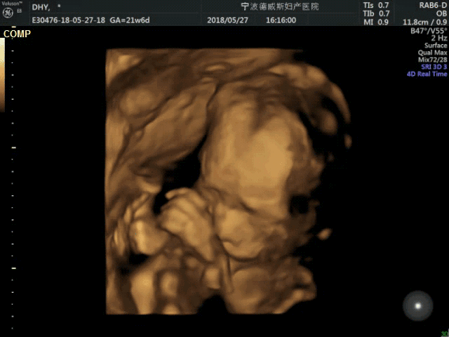 四维产检在多少周时去做最好?