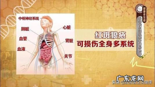 喜欢的人得了红斑狼疮,该怎么办