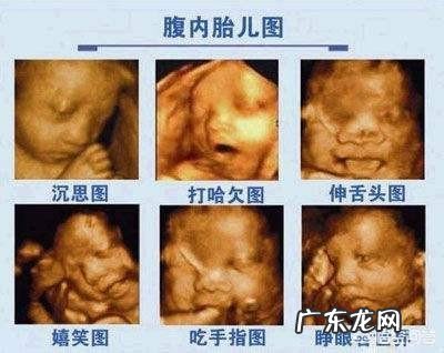 做四维的最佳时间是多少周,要注意什么?