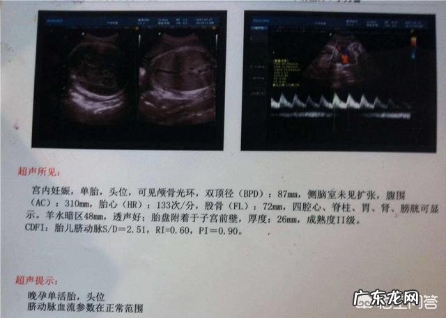 做四维的最佳时间是多少周，要注意什么？