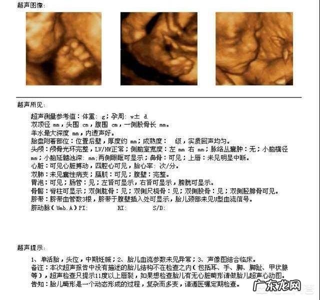做四维的最佳时间是多少周,要注意什么?