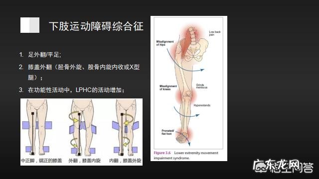 筋膜炎现站坐都很累…怎么zhi