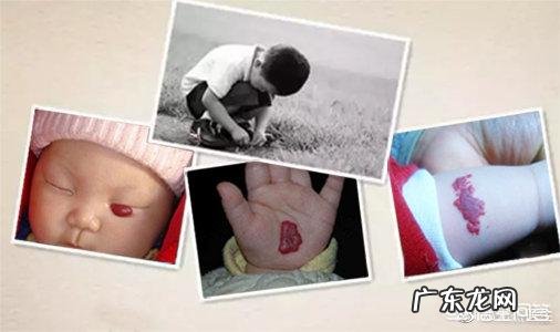 血管瘤患者饮食注意事项有哪些