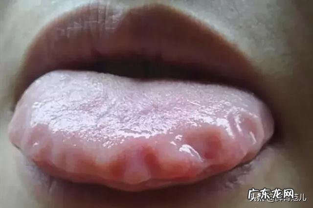 有胃病,用什么泡水长期喝比较好