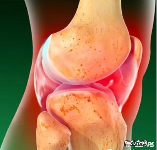 得了关节炎,害怕伤膝盖,该如何通过运动减肥