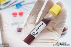 对于高血脂和心血管的患者，他汀药物必须晚上才能吃吗