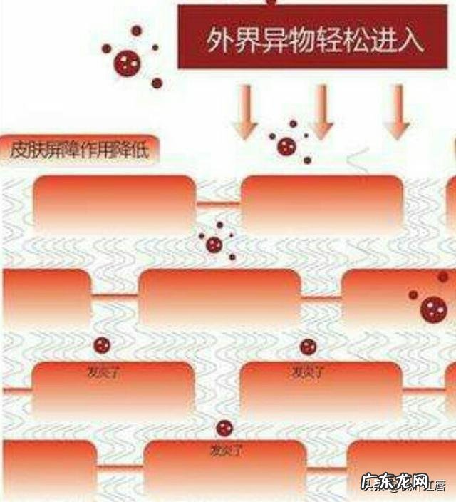 油皮+痘痘肌+敏感怎么护肤呢有什么好的护肤品推荐