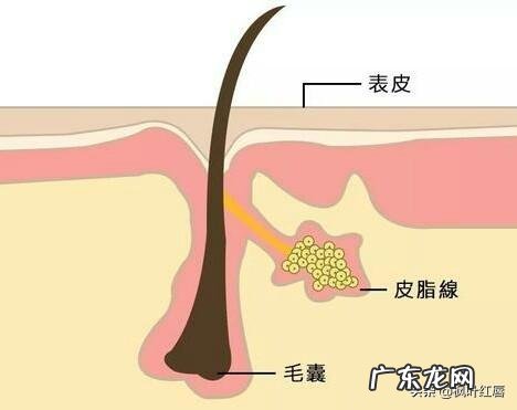 油皮+痘痘肌+敏感怎么护肤呢有什么好的护肤品推荐