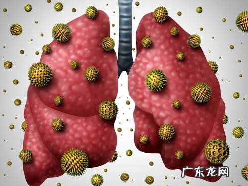 肺结节是什么?会发展成癌吗?