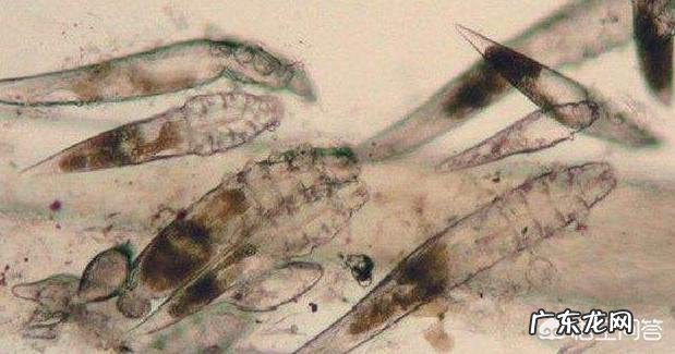 过量使用护肤品会导致毛孔粗大吗