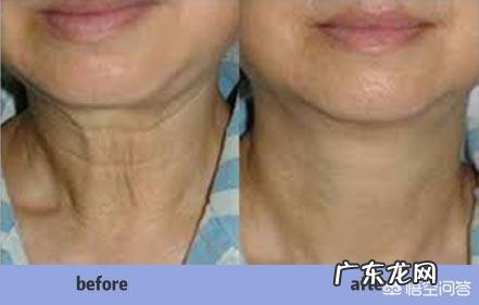 女人如何练出锁骨怎么才能有锁骨