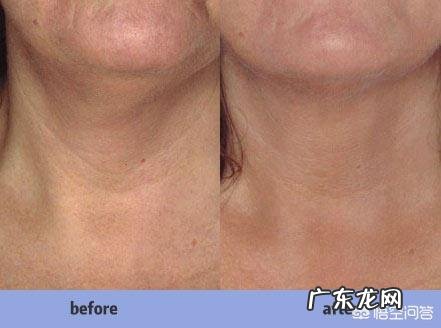 女人如何练出锁骨怎么才能有锁骨