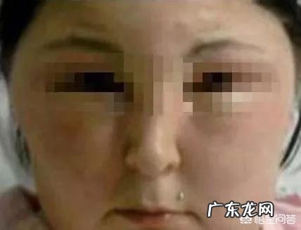 市面上声称能瘦脸的精华产品真的有用吗