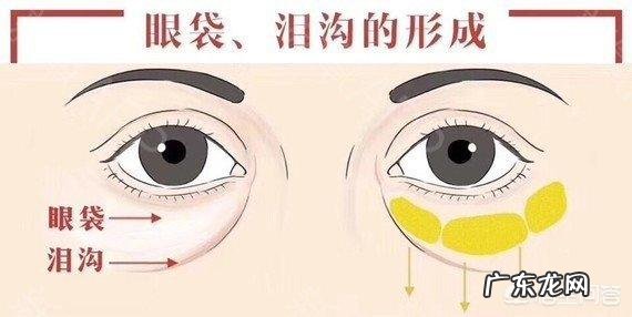 蜂蜜和纯奶小苏打怎么样去眼袋