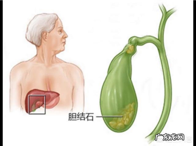 右侧后背部疼痛,这是怎么回事
