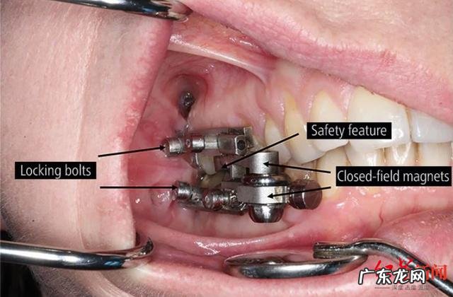 如何有效的使用健身房的器材去减脂塑型