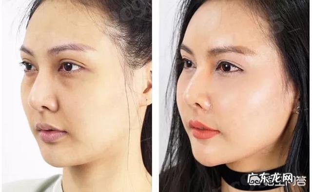 因为眼部有细纹开始用眼霜,结果开始长脂肪粒,该怎么办