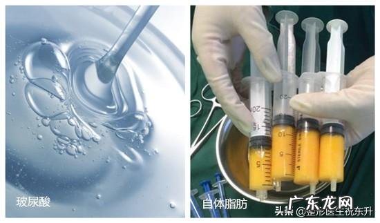 注射的玻尿酸被吸收后,皮肤会松弛吗