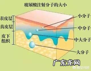 注射的玻尿酸被吸收后,皮肤会松弛吗