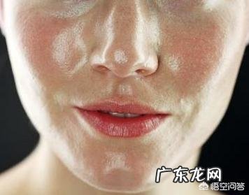 脸上出油多有什么好的方法有效控油吗