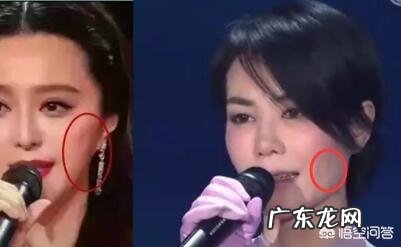 线雕后苹果肌大了,能恢复吗