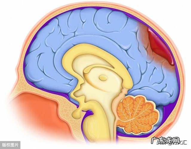 中风、脑出血患者能自己在家喝银杏叶茶来帮助恢复吗