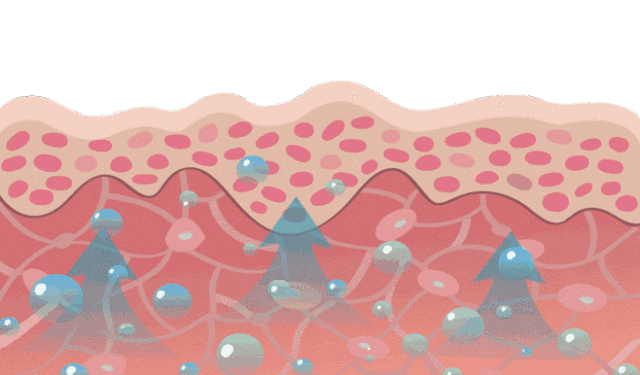 激素脸为什么会紧绷，干燥