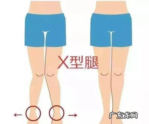 产后必须要做骨盆修复吗能改善屁股大、腰疼是真的还是假的