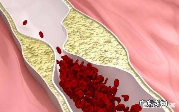 吃阿司匹林一年多时间了,现在能停用吗要注意什么