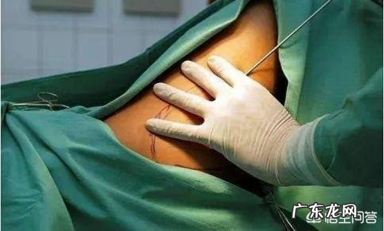 抽脂减肥的风险有多大有多痛苦