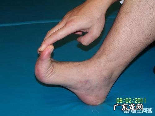 如何预防及缓解足底筋膜炎