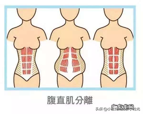 剖腹产后,肚子还像那么回事,处于哺乳期如何消除大肚子呢