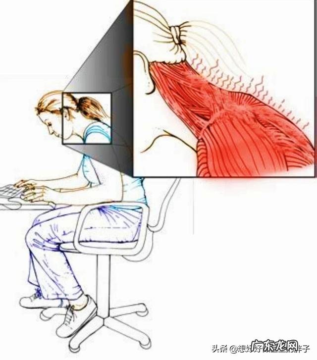 腰背筋膜炎谁有好的zhi疗方法