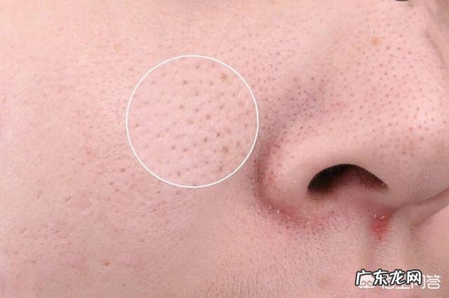 有什么方法能去除毛孔垃圾并收缩毛孔吗