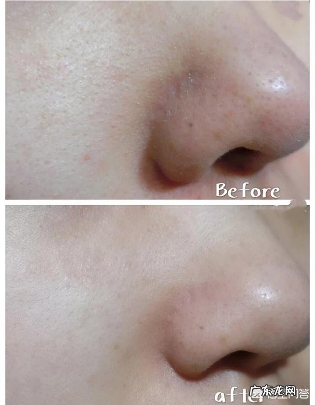 有什么方法能去除毛孔垃圾并收缩毛孔吗