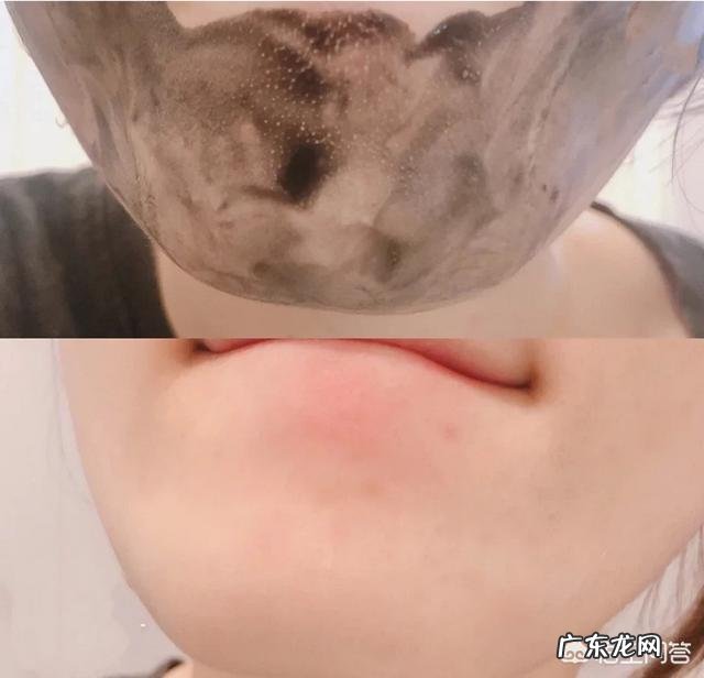 有什么方法能去除毛孔垃圾并收缩毛孔吗