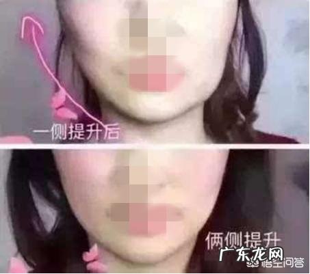 线雕过程要多长时间需要注意哪些