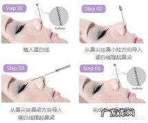 做完线雕鼻后有哪些注意事项线雕鼻多久能化妆