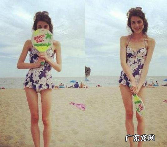 英国威尔士的女孩减肥得厌食症 减肥患厌食症