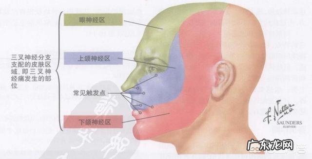 三叉神经痛的临床表现是怎样的