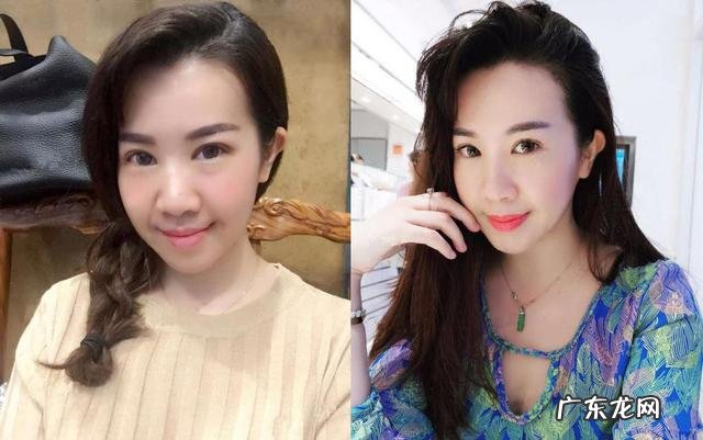 防止出现法令纹，年轻时该如何保养