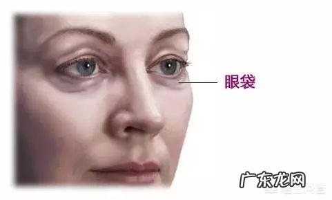 什么方法或者美容品去眼袋效果好