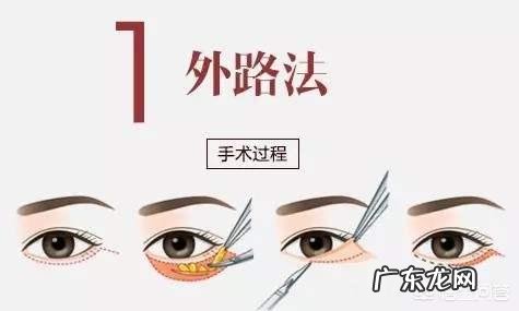 什么方法或者美容品去眼袋效果好