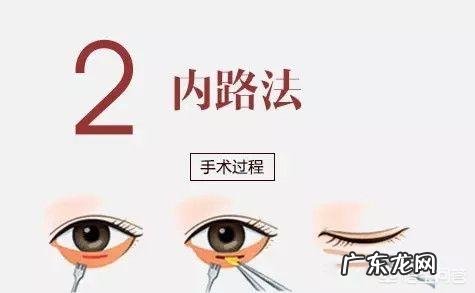什么方法或者美容品去眼袋效果好
