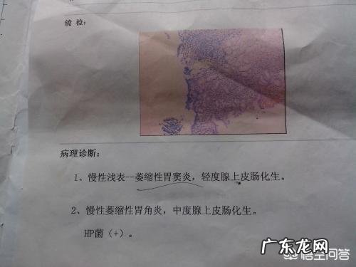 胃部出现癌变会有哪些征兆