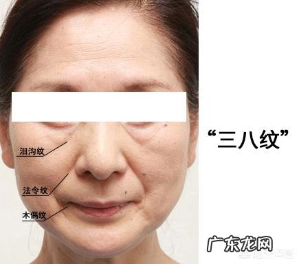 如何改善脸部的下垂和法令纹