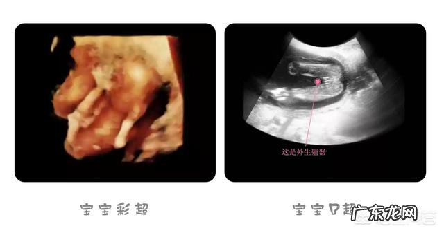 怀孕到了第4个月的时候是什么感觉呢