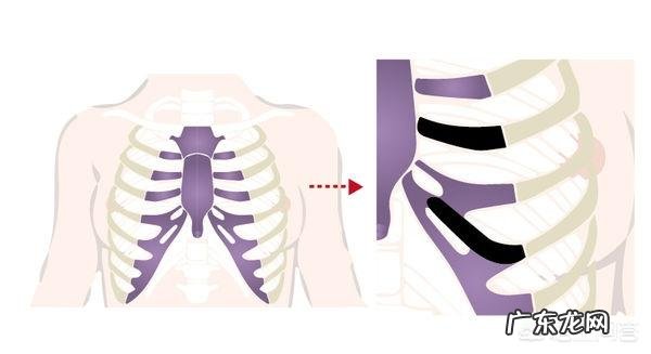 肋骨隆鼻后,肋骨会被吸收吗原因是什么需要注意哪些问题
